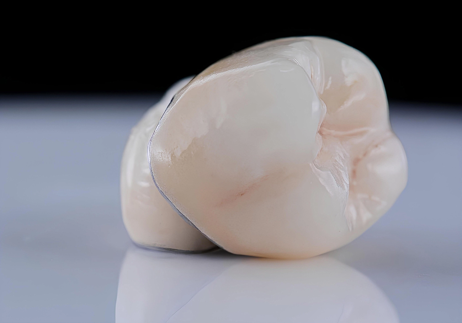 Dental Crown